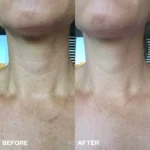 Bio-Collagen kaelamask kollageeniga - Pilt 4